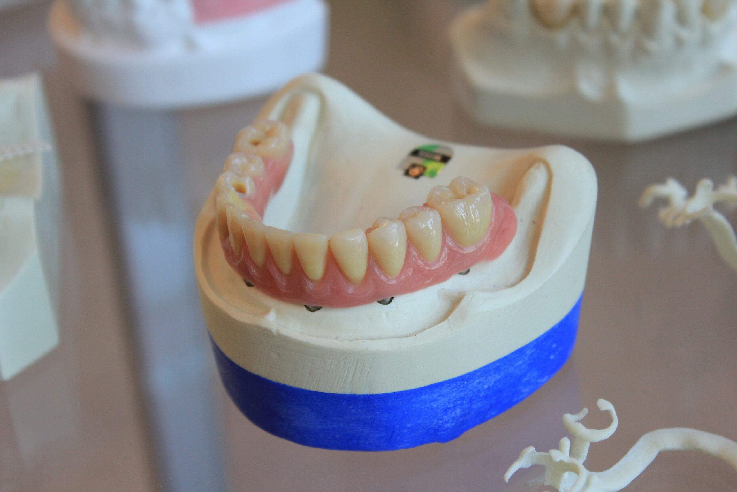 Thinking of Selling Your Dental Practice to a DSO? Read This First